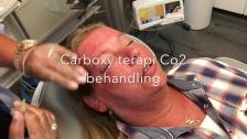 Carboxy Behandling